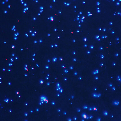microscope image of free bacteria (blue: heterotrophic; red: autotrophic)