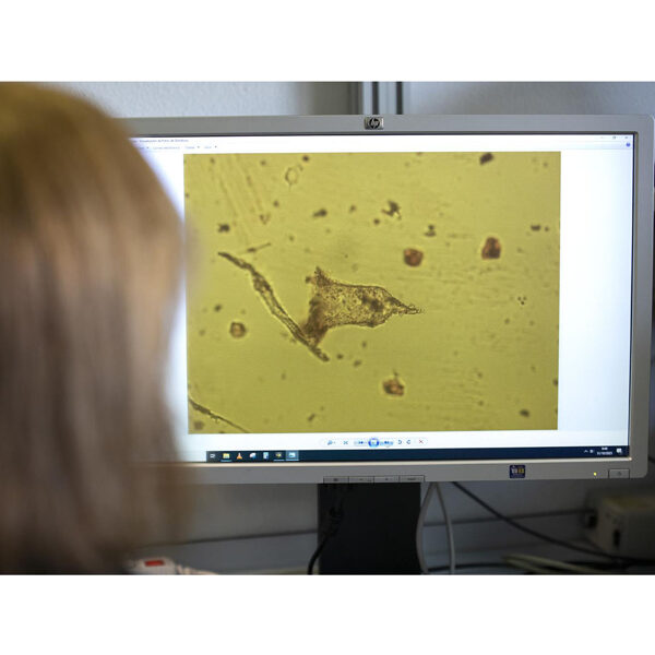 Identifying planktonic protozooa