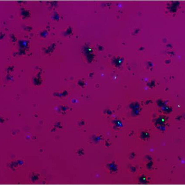 tinción de bacterias planctónicas y autoradiografía