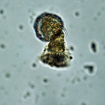 Dictyocysta lepida (ciliado planctónico)