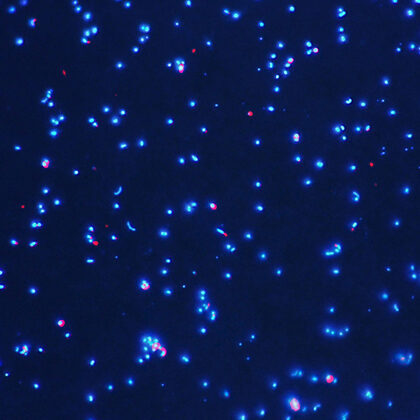 bacterias planctónicas observadas con epifluorescencia