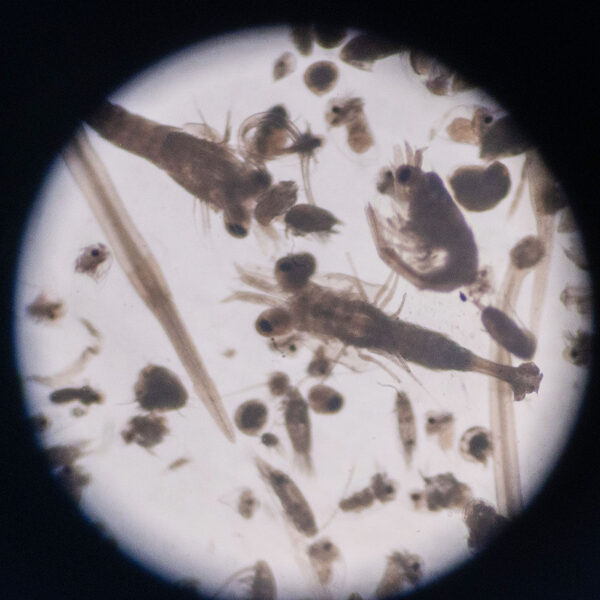 zooplancton observado al estereomicrosopio